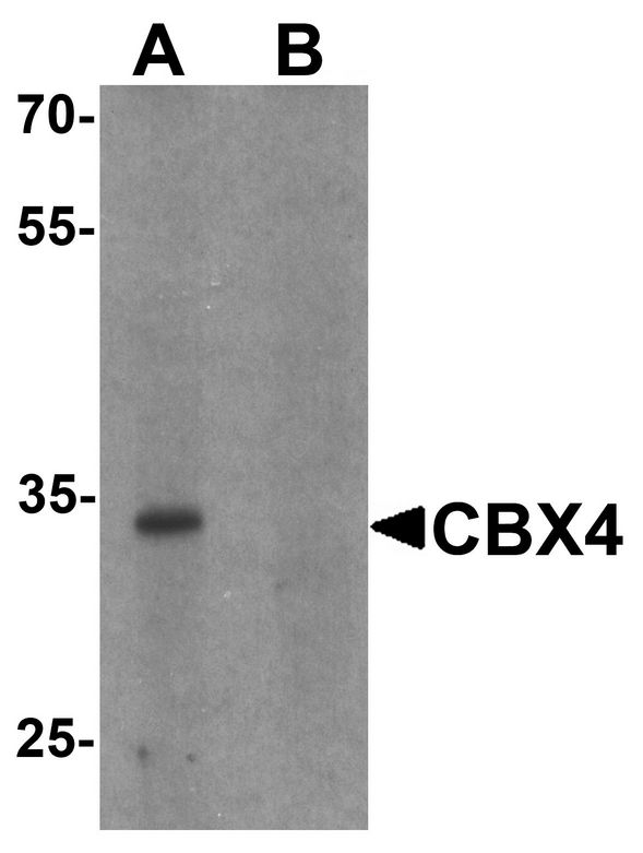 CBX4 Antibody - Western blot analysis of CBX4 in human brain tissue lysate with CBX4 antibody at 1 ug/ml in (A) the absence and (B) the presence of blocking peptide.