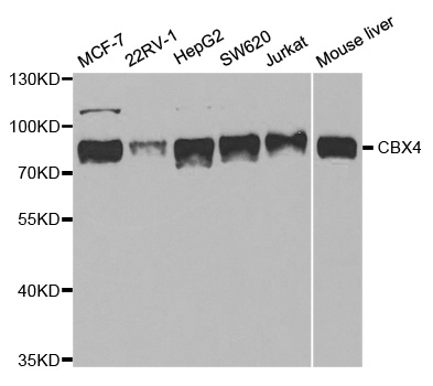 CBX4 Antibody - Western blot analysis of extracts of various cell lines.