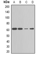 CBX4 Antibody - Western blot analysis of CBX4 expression in MCF7 (A); HepG2 (B); Jurkat (C); mouse liver (D) whole cell lysates.