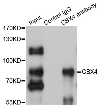 CBX4 Antibody - Immunoprecipitation analysis of 200ug extracts of HepG2 cells using 1ug CBX4 antibody. Western blot was performed from the immunoprecipitate using CBX4 antibody at a dilition of 1:500.