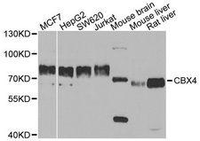 CBX4 Antibody - Western blot analysis of extracts of various cell lines, using CBX4 antibody at 1:1000 dilution. The secondary antibody used was an HRP Goat Anti-Rabbit IgG (H+L) at 1:10000 dilution. Lysates were loaded 25ug per lane and 3% nonfat dry milk in TBST was used for blocking. An ECL Kit was used for detection and the exposure time was 60s.