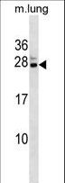 CBX5 / HP1 Alpha Antibody - Mouse Cbx5 Antibody western blot of mouse lung tissue lysates (35 ug/lane). The Cbx5 antibody detected the Cbx5 protein (arrow).