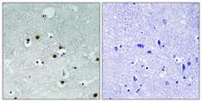 CBX5 / HP1 Alpha Antibody - Immunohistochemistry analysis of paraffin-embedded human brain tissue, using HP1 alpha Antibody. The picture on the right is blocked with the synthesized peptide.