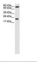 CBX5 / HP1 Alpha Antibody - Fetal Brain Lysate.  This image was taken for the unconjugated form of this product. Other forms have not been tested.