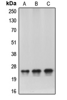 CBX5 / HP1 Alpha Antibody - Western blot analysis of HP1 alpha expression in HeLa (A); NIH3T3 (B); C6 (C) whole cell lysates.