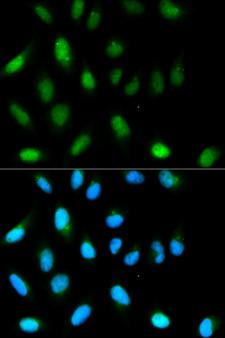 CBX5 / HP1 Alpha Antibody - Immunofluorescence analysis of HeLa cells using CBX5 antibody. Blue: DAPI for nuclear staining.