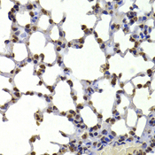 CBX5 / HP1 Alpha Antibody - Immunohistochemistry of paraffin-embedded mouse lung using CBX5 antibody at dilution of 1:100 (40x lens).