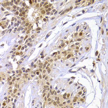 CBX5 / HP1 Alpha Antibody - Immunohistochemistry of paraffin-embedded human mammary gland using CBX5 antibody at dilution of 1:100 (40x lens).