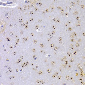 CBX5 / HP1 Alpha Antibody - Immunohistochemistry of paraffin-embedded mouse brain using CBX5 antibody at dilution of 1:100 (40x lens).