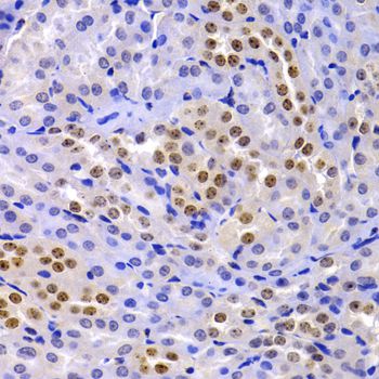 CBX5 / HP1 Alpha Antibody - Immunohistochemistry of paraffin-embedded mouse kidney using CBX5 antibody at dilution of 1:100 (40x lens).