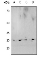 CBX5 / HP1 Alpha Antibody - Western blot analysis of HP1 alpha (pS92) expression in PC3 (A), mouse heart (B), mouse brain (C), rat heart (D) whole cell lysates.
