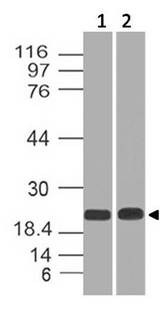 CBX5 / HP1 Alpha Antibody - Fig-1: Expression analysis of Cbx5. Anti-Cbx5 antibody was used at 1 µg/ml on (1) MCF-7 and (2) Hela lysates.