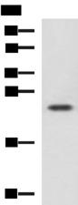 CBX5 / HP1 Alpha Antibody - Western blot analysis of Jurkat cell lysate  using CBX5 Polyclonal Antibody at dilution of 1:1100