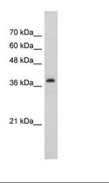 CBX6 Antibody - Jurkat Cell Lysate.  This image was taken for the unconjugated form of this product. Other forms have not been tested.