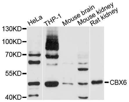 CBX6 Antibody - Western blot analysis of extracts of HepG2 cells.