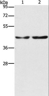 CBX6 Antibody - Western blot analysis of HeLa and 293T cell, using CBX6 Polyclonal Antibody at dilution of 1:600.