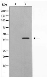CBX6 Antibody - Western blot of 293 cell lysate using CBX6 Antibody