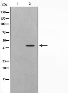 CBX6 Antibody - Western blot analysis on 293 cell lysates using CBX6 antibody. The lane on the left is treated with the antigen-specific peptide.