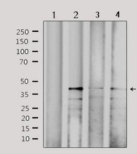 CBX6 Antibody - Western blot analysis of extracts of various samples using CBX6 antibody. Lane 1: 293 treated with blocking peptide; Lane 2: 293; Lane 3: HepG2; Lane 4: HeLa;