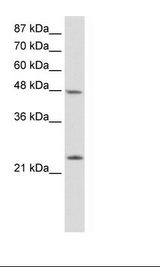CBX6 Antibody - HepG2 Cell Lysate.  This image was taken for the unconjugated form of this product. Other forms have not been tested.