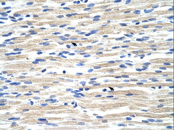 CBX6 Antibody - CBX6 antibody ARP39073_T100-NP_055107-CBX6 (chromobox homolog 6) Antibody was used in IHC to stain formalin-fixed, paraffin-embedded human muscle.  This image was taken for the unconjugated form of this product. Other forms have not been tested.