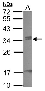 CBX7 Antibody - Sample (30 ug of whole cell lysate) A: HeLa 12% SDS PAGE CBX7 antibody diluted at 1:1000