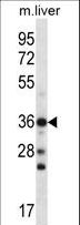 CBX8 Antibody - CBX8 Antibody western blot of mouse liver tissue lysates (35 ug/lane). The CBX8 antibody detected the CBX8 protein (arrow).