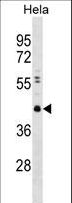 CBX8 Antibody - CBX8 Antibody (Y321) western blot of HeLa cell line lysates (35 ug/lane). The CBX8 antibody detected the CBX8 protein (arrow).