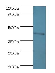 CBX8 Antibody - Western blot. All lanes: CBX8 antibody at 2 ug/ml+Jurkat whole cell lysate. Secondary antibody: Goat polyclonal to rabbit at 1:10000 dilution. Predicted band size: 43 kDa. Observed band size: 43 kDa Immunohistochemistry.