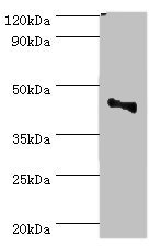 CBX8 Antibody - Western blot All lanes: CBX8 antibody at 2µg/ml + Jurkat whole cell lysate Secondary Goat polyclonal to rabbit IgG at 1/10000 dilution Predicted band size: 43 kDa Observed band size: 43 kDa