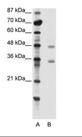 CBX8 Antibody - A: Marker, B: Jurkat Cell Lysate.  This image was taken for the unconjugated form of this product. Other forms have not been tested.