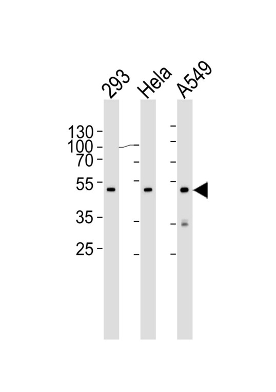 CBX8 Antibody - Western blot of lysates from 293, HeLa, A549 cell line (from left to right) with CBX8 Antibody. Antibody was diluted at 1:1000 at each lane. A goat anti-mouse IgG H&L (HRP) at 1:3000 dilution was used as the secondary antibody. Lysates at 35 ug per lane.