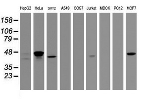 CBX8 Antibody - Western blot of extracts (35 ug) from 9 different cell lines by using g anti-CBX8 monoclonal antibody (HepG2: human; HeLa: human; SVT2: mouse; A549: human; COS7: monkey; Jurkat: human; MDCK: canine; PC12: rat; MCF7: human).