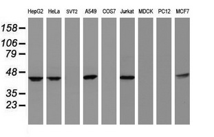 CBX8 Antibody - Western blot of extracts (35 ug) from 9 different cell lines by using anti-CBX8 monoclonal antibody (HepG2: human; HeLa: human; SVT2: mouse; A549: human; COS7: monkey; Jurkat: human; MDCK: canine; PC12: rat; MCF7: human).