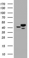 CBX8 Antibody - HEK293T cells were transfected with the pCMV6-ENTRY control (Left lane) or pCMV6-ENTRY CBX8 (Right lane) cDNA for 48 hrs and lysed. Equivalent amounts of cell lysates (5 ug per lane) were separated by SDS-PAGE and immunoblotted with anti-CBX8.