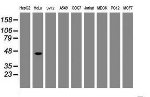 CBX8 Antibody - Western blot of extracts (35 ug) from 9 different cell lines by using anti-CBX8 monoclonal antibody (HepG2: human; HeLa: human; SVT2: mouse; A549: human; COS7: monkey; Jurkat: human; MDCK: canine; PC12: rat; MCF7: human).