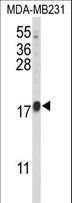 CBY1 / PGEA1 Antibody - Western blot of HRIHFB2025 Antibody in MDA-MB231 cell line lysates (35 ug/lane). HRIHFB2025 (arrow) was detected using the purified antibody.