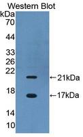 CBY1 / PGEA1 Antibody - Western Blot; Sample: Recombinant protein.