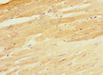 CBY1 / PGEA1 Antibody - Immunohistochemistry of paraffin-embedded human heart tissue at dilution 1:100