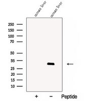 CBY1 / PGEA1 Antibody - Western blot analysis of extracts of mouse liver tissue using CBY1 antibody. The lane on the left was treated with blocking peptide.