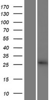 CBY3 Protein - Western validation with an anti-DDK antibody * L: Control HEK293 lysate R: Over-expression lysate