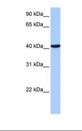 CC2D1B Antibody - Placenta cell lysate. Antibody concentration: 1.0 ug/ml. Gel concentration: 12%.  This image was taken for the unconjugated form of this product. Other forms have not been tested.