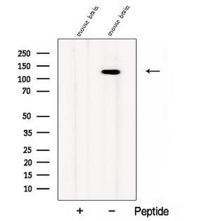 CC2D1B Antibody - Western blot analysis of extracts of mouse brain tissue using CC2D1B antibody. The lane on the left was treated with blocking peptide.