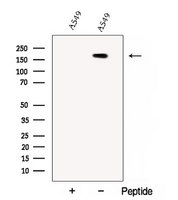 CC2D2A Antibody - Western blot analysis of extracts of A549 cells using CC2D2A antibody. The lane on the left was treated with blocking peptide.