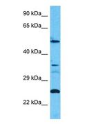CC2D2B Antibody - Western blot of CC2D2B Antibody with human HT1080 Whole Cell lysate.  This image was taken for the unconjugated form of this product. Other forms have not been tested.