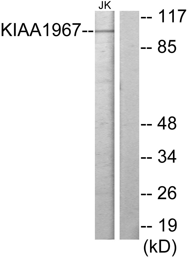 CCAR2 / KIAA1967 Antibody - Western blot analysis of lysates from Jurkat cells, using KIAA1967 Antibody. The lane on the right is blocked with the synthesized peptide.