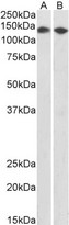 CCAR2 / KIAA1967 Antibody - Antibody (0.5µg/ml) staining of HEK293 (A) and MCF7 (B) nuclear lysates (35µg protein in RIPA buffer). Primary incubation was 1 hour. Detected by chemiluminescence.