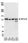 CCAR2 / KIAA1967 Antibody - Detection of Human DBC1/p30 by Western Blot. Samples: Whole cell lysate from 293T (15 and 50 ug), HeLa (50 ug), and Jurkat (50 ug) cells. Antibodies: Affinity purified goat anti-DBC1/p30 antibody used for WB at 0.1 ug/ml. Detection: Chemiluminescence with an exposure time of 30 seconds.
