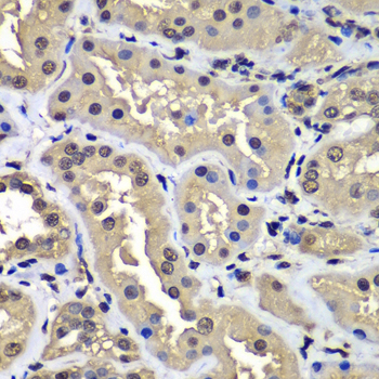 CCAR2 / KIAA1967 Antibody - Immunohistochemistry of paraffin-embedded human kidney tissue.