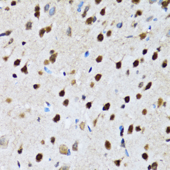 CCAR2 / KIAA1967 Antibody - Immunohistochemistry of paraffin-embedded rat brain tissue.